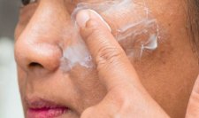 รู้จักชนิดของฝ้า (Melasma) วิธีดูแลรักษาให้หายขาด