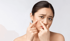 สิวหิน (SYRINGOMA) คืออะไร รักษาอย่างไรให้เห็นผล