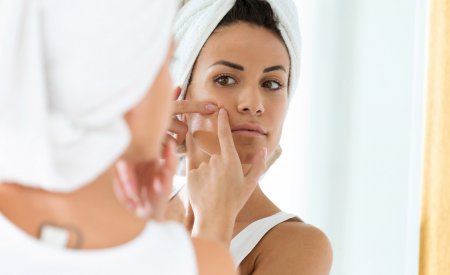 Bioderma - Adult woman with acne