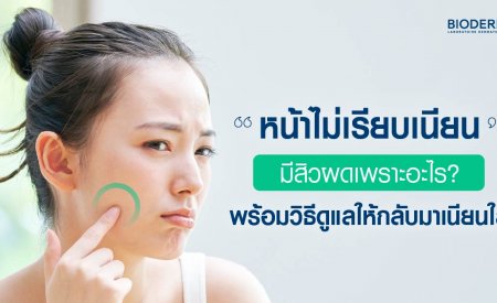 หน้าไม่เรียบเนียน มีสิวผดเพราะอะไร? พร้อมวิธีดูแลให้กลับมาเนียนใส