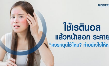 ใช้เรตินอลแล้วหน้าลอก ระคาย ควรหยุดใช้ไหม? ทำอย่างไรให้หาย