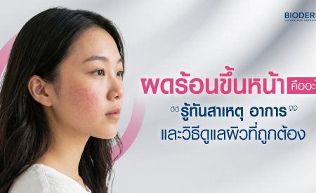 ผดร้อนขึ้นหน้าคืออะไร รู้ทันสาเหตุ อาการ และวิธีดูแลผิวที่ถูกต้อง