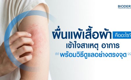 ผื่นแพ้เสื้อผ้าคืออะไร? เข้าใจสาเหตุ อาการ พร้อมวิธีดูแลอย่างตรงจุด