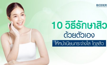 10 วิธีรักษาสิวด้วยตัวเอง ให้หน้าเนียนกระจ่างใส ไกลสิว