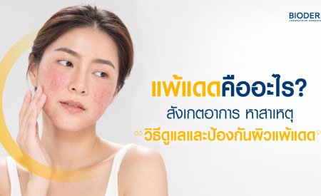 แพ้แดดคืออะไร? สังเกตอาการ หาสาเหตุ วิธีดูแลและป้องกันผิวแพ้แดด
