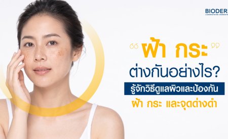 ฝ้า กระ ต่างกันอย่างไร? รู้จักวิธีดูแลผิวและป้องกันฝ้า กระ และจุดด่างดํา