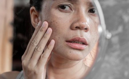 7 วิธีกู้ผิวคล้ำเสีย ดำแดด ให้กลับมาขาวกระจ่างใส