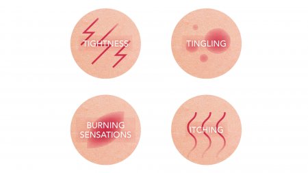 Sensitive skin symptoms