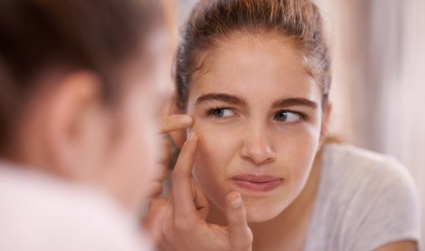 Bioderma - Adolescent with acne