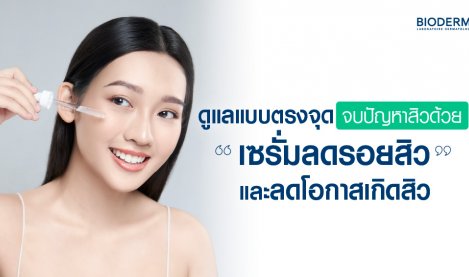 ดูแลแบบตรงจุด จบปัญหาสิวด้วยเซรั่มลดรอยสิวและลดโอกาสเกิดสิว