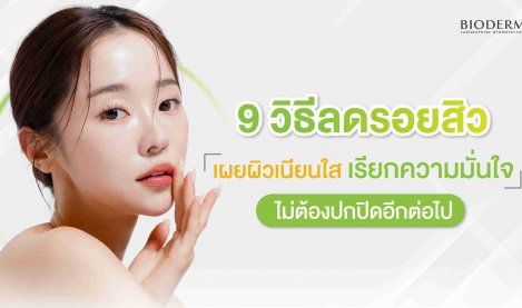 9 วิธีลดรอยสิว เผยผิวเนียนใส เรียกความมั่นใจ ไม่ต้องปกปิดอีกต่อไป