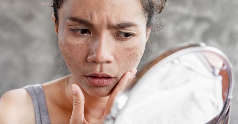 วิธีแก้หน้าหมองคล้ำ ผิวโทรม รักษาอย่างตรงจุด ฟื้นฟูผิวกระจ่างใส | BIODERMA วิธีแก้หน้าหมองคล้ำ ผิวโทรม รักษาอย่างตรงจุด ฟื้นฟูผิวกระจ่างใส | Bioderma